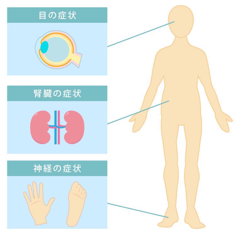 合併症の例:目の症状・腎臓の症状・神経の症状